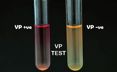 voges proskauer test results